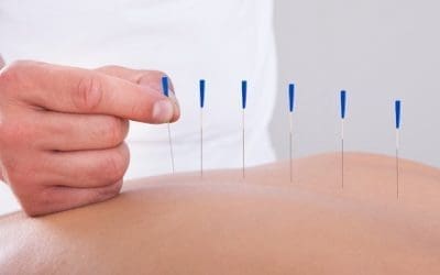 Acupuncture-like Stimulation